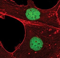 Invitrogen EVI1 Monoclonal Antibody (S.446.4) 100 &mu;L; Unconjugated:Antibodies,