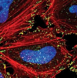 Invitrogen NUMB Monoclonal Antibody (S.925.4) 100 &mu;L; Unconjugated:Antibodies,