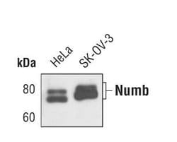 Invitrogen NUMB Monoclonal Antibody (S.925.4) 100 &mu;L; Unconjugated:Antibodies,