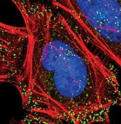 Invitrogen NUMB Monoclonal Antibody (T.873.4) 100 &mu;L; Unconjugated:Antibodies,