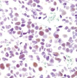 Invitrogen CDK9 Monoclonal Antibody (K.513.1) 100 &mu;L; Unconjugated:Antibodies,