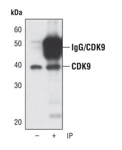 Invitrogen CDK9 Monoclonal Antibody (K.513.1) 100 &mu;L; Unconjugated:Antibodies,