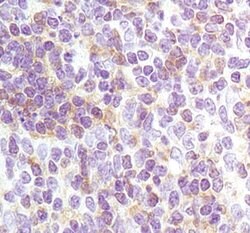 Invitrogen Lyn Monoclonal Antibody (R.677.10) 100 &mu;L | Buy Online | Invitrogen&trade; | Fisher Scientific