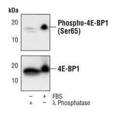 Invitrogen Phospho-4EBP1 (Ser65) Monoclonal Antibody (T.730.9) 100 &mu;L;