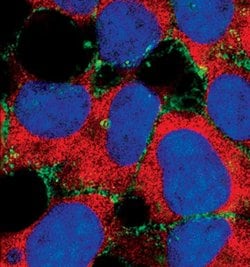 Invitrogen alpha N-Catenin Monoclonal Antibody (T.44.7) 100 &mu;L; Unconjugated:Antibodies,