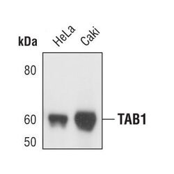 Invitrogen TAB1 Monoclonal Antibody (F.211.6) 100 &mu;L | Buy Online | Invitrogen&trade; | Fisher Scientific
