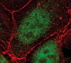 Invitrogen TCF7 Monoclonal Antibody (C.725.7) 100 &mu;L; Unconjugated:Antibodies,