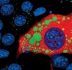 Invitrogen ATGL Monoclonal Antibody (K.751.7) 100 &mu;L; Unconjugated:Antibodies,