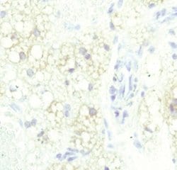 Invitrogen ATGL Monoclonal Antibody (K.751.7) 100 &mu;L; Unconjugated:Antibodies,