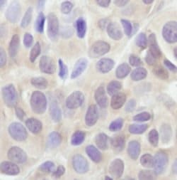 Invitrogen AKT Pan Monoclonal Antibody (E.32.10) 100 &mu;L; Unconjugated:Antibodies,