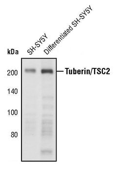 Invitrogen TSC2 Monoclonal Antibody (T.309.0) 100 &mu;L; Unconjugated:Antibodies,