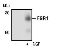 Invitrogen EGR1 Monoclonal Antibody (T.160.5) 100 &mu;L; Unconjugated:Antibodies,