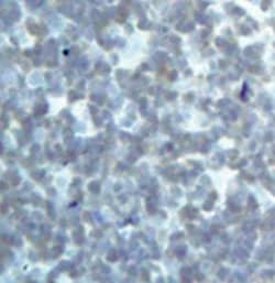 Invitrogen DRAK2 Monoclonal Antibody (E.959.6) 100 &mu;L; Unconjugated:Antibodies,