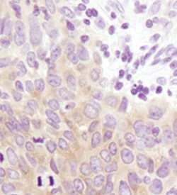 Invitrogen GYS1 Monoclonal Antibody (J.18.5) 100 &mu;L; Unconjugated:Antibodies,