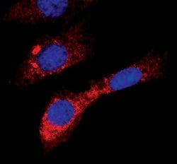 Invitrogen Acetyl-CoA Carboxylase Monoclonal Antibody (B.800.8) 100 &mu;L;