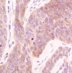 Invitrogen Acetyl-CoA Carboxylase Monoclonal Antibody (B.800.8) 100 &mu;L;
