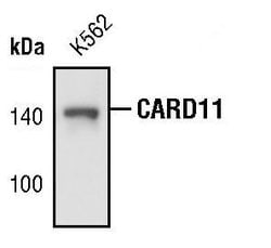 Invitrogen CARD11 Monoclonal Antibody (B.472.3) 100 &mu;L | Buy Online | Invitrogen&trade; | Fisher Scientific