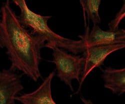 Invitrogen RSK1/RSK2/RSK3 Monoclonal Antibody (F.940.7) 100 &mu;L; Unconjugated:Antibodies,