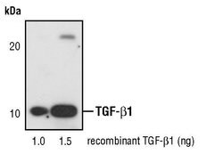 Invitrogen TGF beta-1 Monoclonal Antibody (F.888.7) 100 &mu;L; Unconjugated:Antibodies,