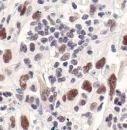 Invitrogen Survivin Monoclonal Antibody (J.33.5) 100 &mu;L; Unconjugated:Antibodies,