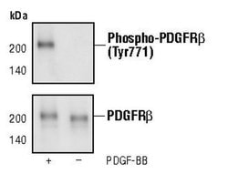 Invitrogen Phospho-PDGFRB (Tyr771) Monoclonal Antibody (G.69.10) 100 &mu;L | Buy Online | Invitrogen&trade; | Fisher Scientific