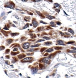 Invitrogen NFkB p52/p100 Monoclonal Antibody (E.212.1) 100 &mu;L; Unconjugated:Antibodies,