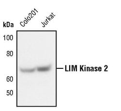 Invitrogen LIMK2 Monoclonal Antibody (T.756.1) 100 &mu;L; Unconjugated:Antibodies,