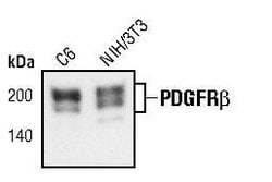 Invitrogen PDGFRB Monoclonal Antibody (G.290.3) 100 &mu;L; Unconjugated:Antibodies,