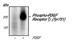 Invitrogen Phospho-PDGFRB (Tyr751) Monoclonal Antibody (C.17.2) 100 &mu;L;