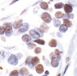 Invitrogen Phospho-Estrogen Receptor alpha (Ser118) Monoclonal Antibody