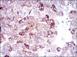 Invitrogen SLC27A5 Monoclonal Antibody (4B11C10) 100 &mu;g; Unconjugated:Antibodies,