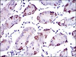 Invitrogen SLC27A5 Monoclonal Antibody (4B11C10) 100 &mu;g; Unconjugated:Antibodies,