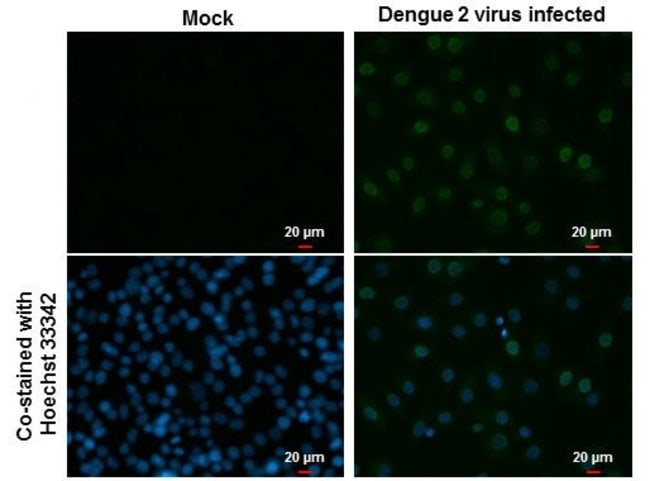 Dengue Virus Type 2 NS5 Monoclonal Antibody (GT353), Invitrogen 100 μL ...