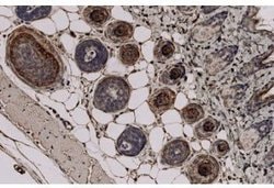 Invitrogen TCHH Monoclonal Antibody (AE15) 100 &mu;L; Unconjugated:Antibodies,
