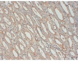 Invitrogen IGF1 Monoclonal Antibody (7973) 100 &mu;L; Unconjugated:Antibodies,