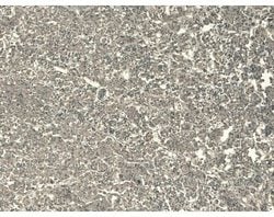 POMC Monoclonal Antibody (6Y8), Invitrogen 100 &mu;L; Unconjugated:Antibodies,