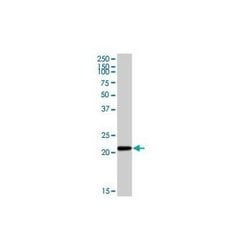 Invitrogen CYBA Monoclonal Antibody (44.1) 100 &mu;L | Buy Online | Invitrogen&trade; | Fisher Scientific