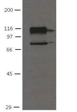 Invitrogen CDH11 Monoclonal Antibody (16G5) 100 &mu;L; Unconjugated:Antibodies,
