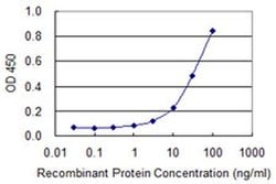 Invitrogen alpha Amylase 2B Monoclonal Antibody (2B12) 100 &mu;g; Unconjugated:Antibodies,