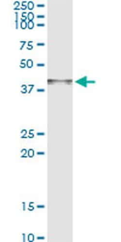 Invitrogen Arginase 2 Monoclonal Antibody (3D10) 100 &mu;g; Unconjugated:Antibodies,