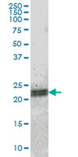 Invitrogen ATF3 Monoclonal Antibody (7G10) 100 &mu;g | Buy Online | Invitrogen&trade; | Fisher Scientific