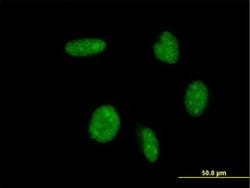 Invitrogen ATOH1 Monoclonal Antibody (4H2) 100 &mu;g; Unconjugated:Antibodies,