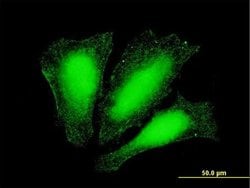 Invitrogen ATOX1 Monoclonal Antibody (4A12) 100 &mu;g; Unconjugated:Antibodies,