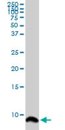 Invitrogen ATOX1 Monoclonal Antibody (4A12) 100 &mu;g; Unconjugated:Antibodies,