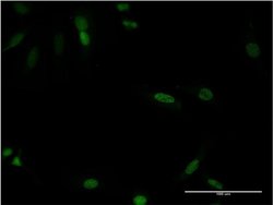 Invitrogen CDX4 Monoclonal Antibody (1E9) 100 &mu;g; Unconjugated:Antibodies,