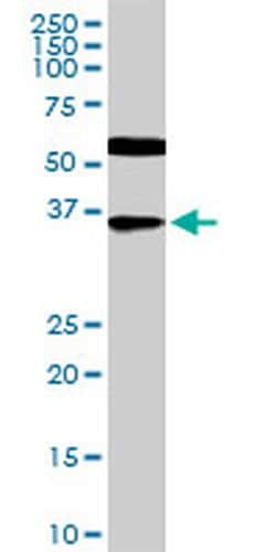 Invitrogen CDX4 Monoclonal Antibody (1E9) 100 &mu;g; Unconjugated:Antibodies,