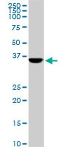 Invitrogen CDX4 Monoclonal Antibody (1E9) 100 &mu;g; Unconjugated:Antibodies,