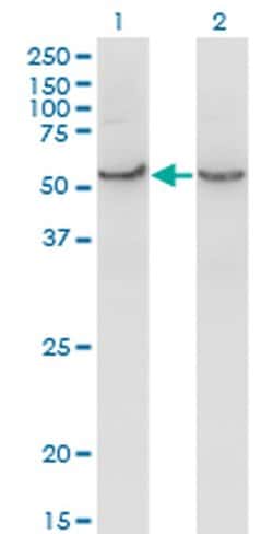 Invitrogen COX15 Monoclonal Antibody (2D2) 100 &mu;g; Unconjugated:Antibodies,
