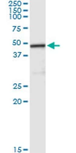 Invitrogen Carboxypeptidase A2 Monoclonal Antibody (2E11) 100 &mu;g; Unconjugated:Antibodies,