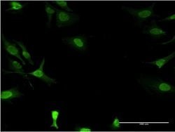 Invitrogen DCK Monoclonal Antibody (2F10) 100 &mu;g; Unconjugated:Antibodies,